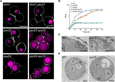 Yeast Vps13 is Crucial for Peroxisome Expansion in Cells With Reduced Peroxisome-ER Contact Sites